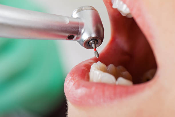 Best Chipped Tooth Repair Near Me  in Arlington Heights, IL